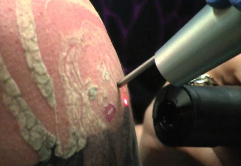 Tetovaže i ožiljci u policiji